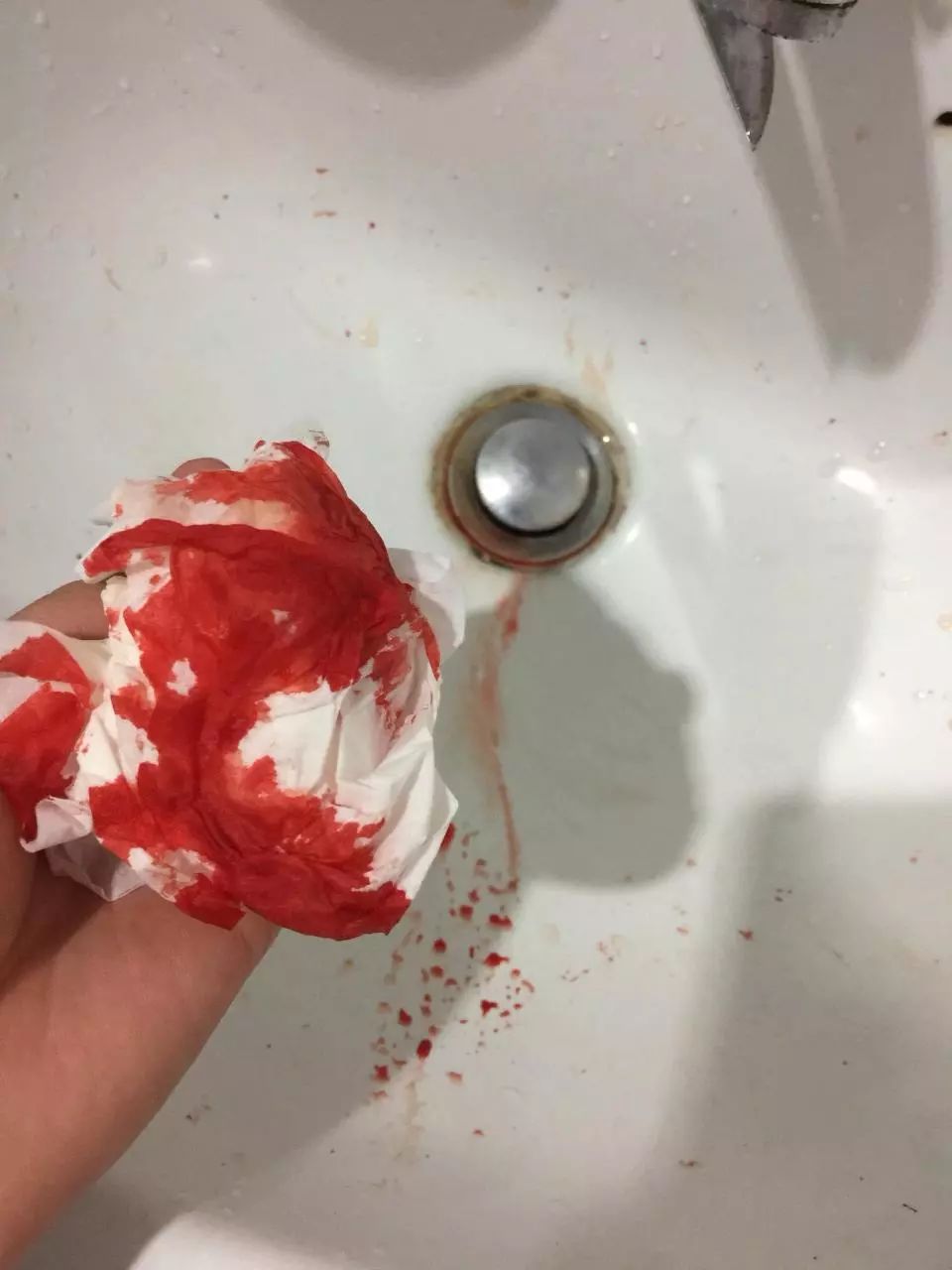 流鼻血照片 洗手间图片