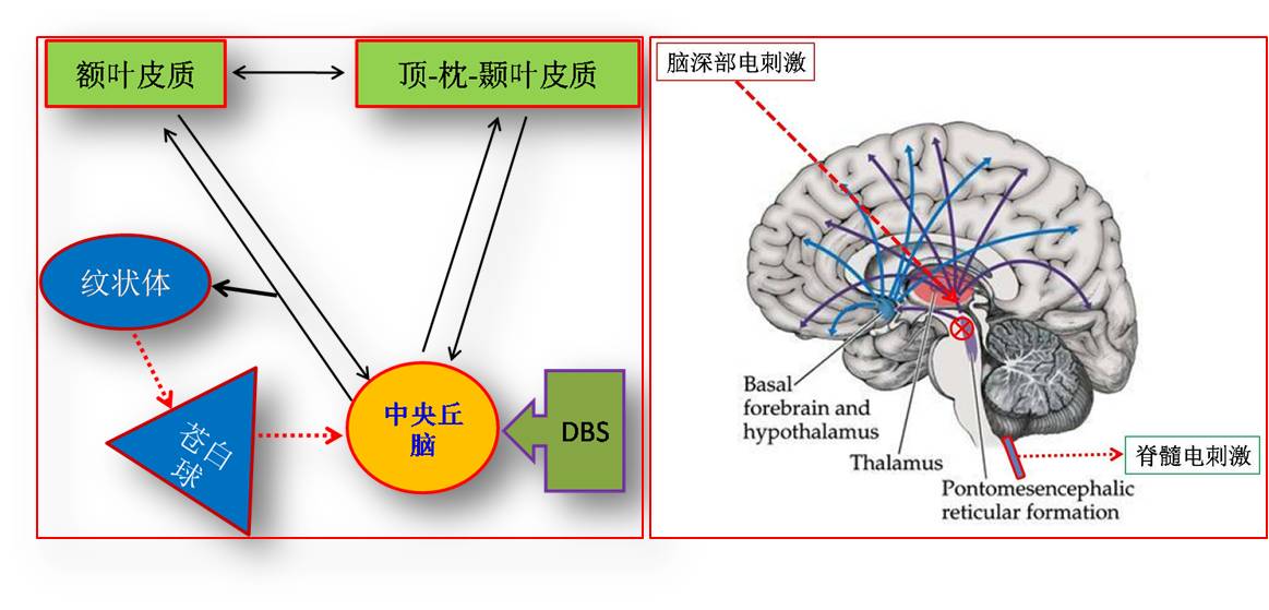 國內外多篇文獻證實了丘腦刺激在意識恢復中的重要作用,丘腦核團眾多