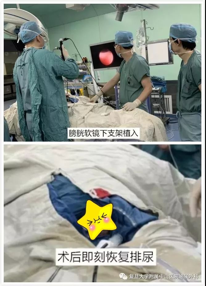 尿道插管手术 男主图片