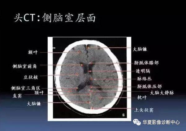 图文总结丨医学影像重要知识速记口诀