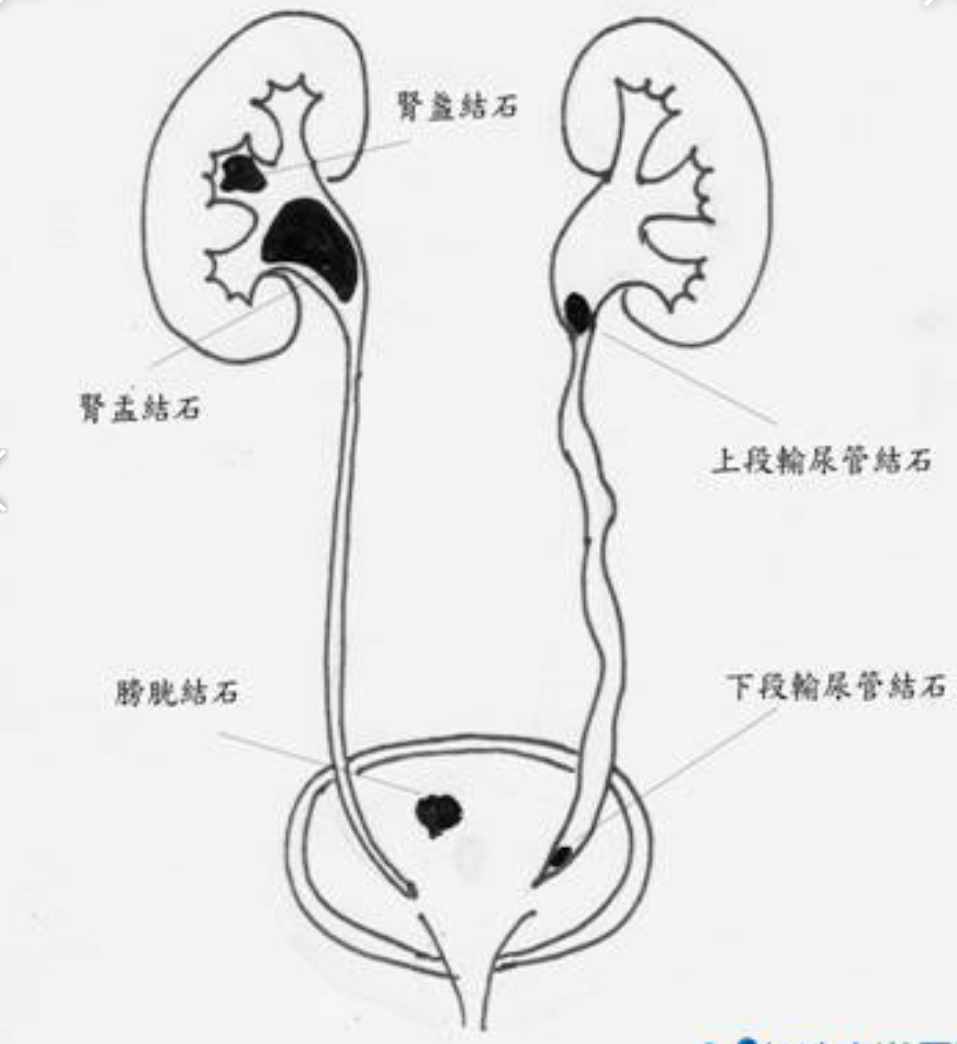 输尿管三段图片