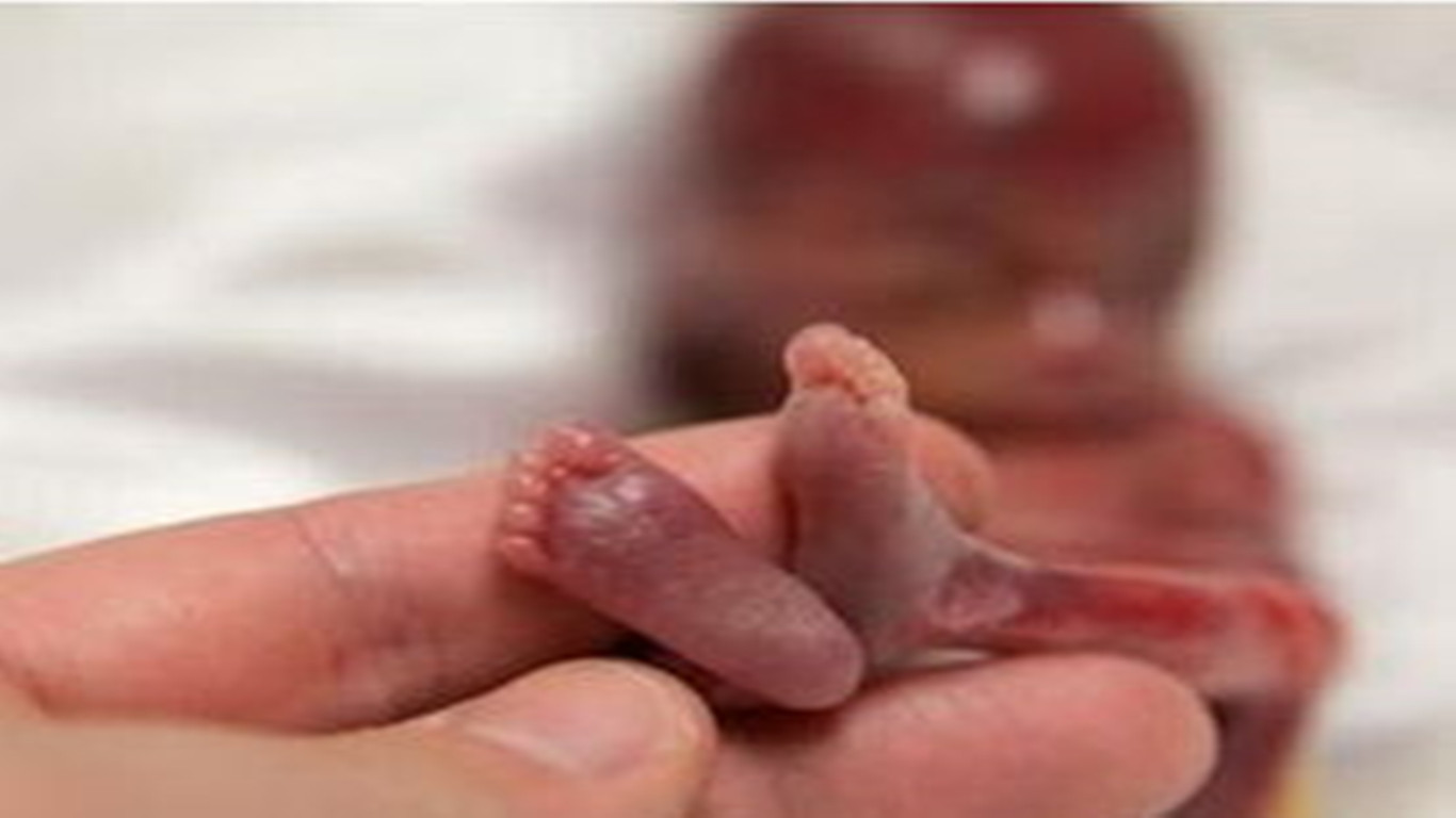 女子怀孕七个月去医院要求引产胎儿被引出时所有人不谈定了