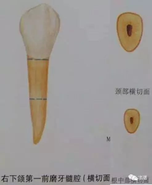 下颌中切牙髓腔形态图片