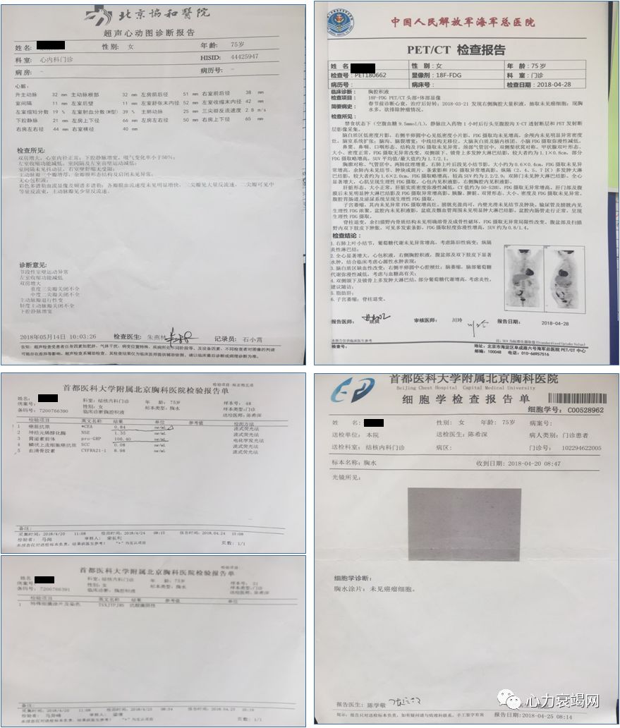 72 既往史:精神分裂症20年,现口服利培酮,病情控制可;高血压10年,最