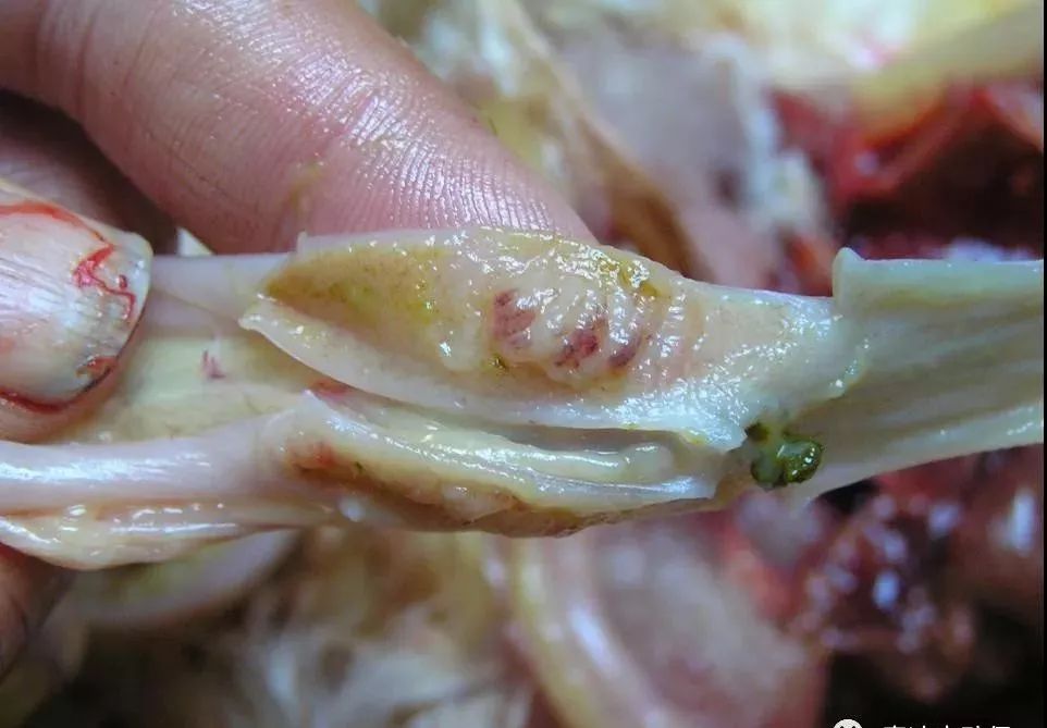 鼻咽菜花状肿物图片