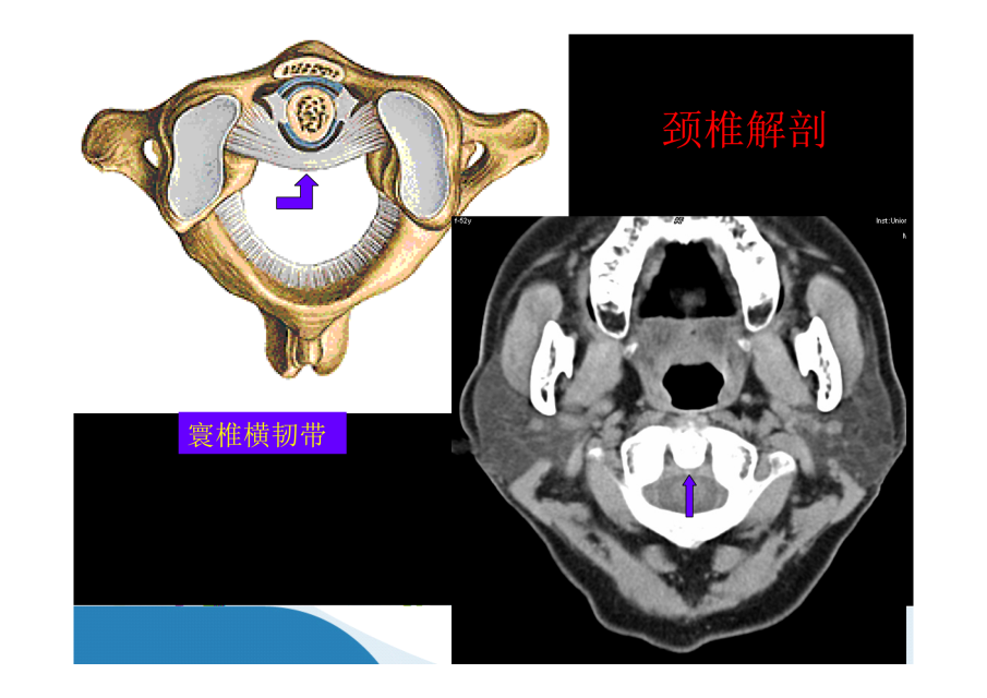 如何看懂x線,ct,mr平片?收藏文章