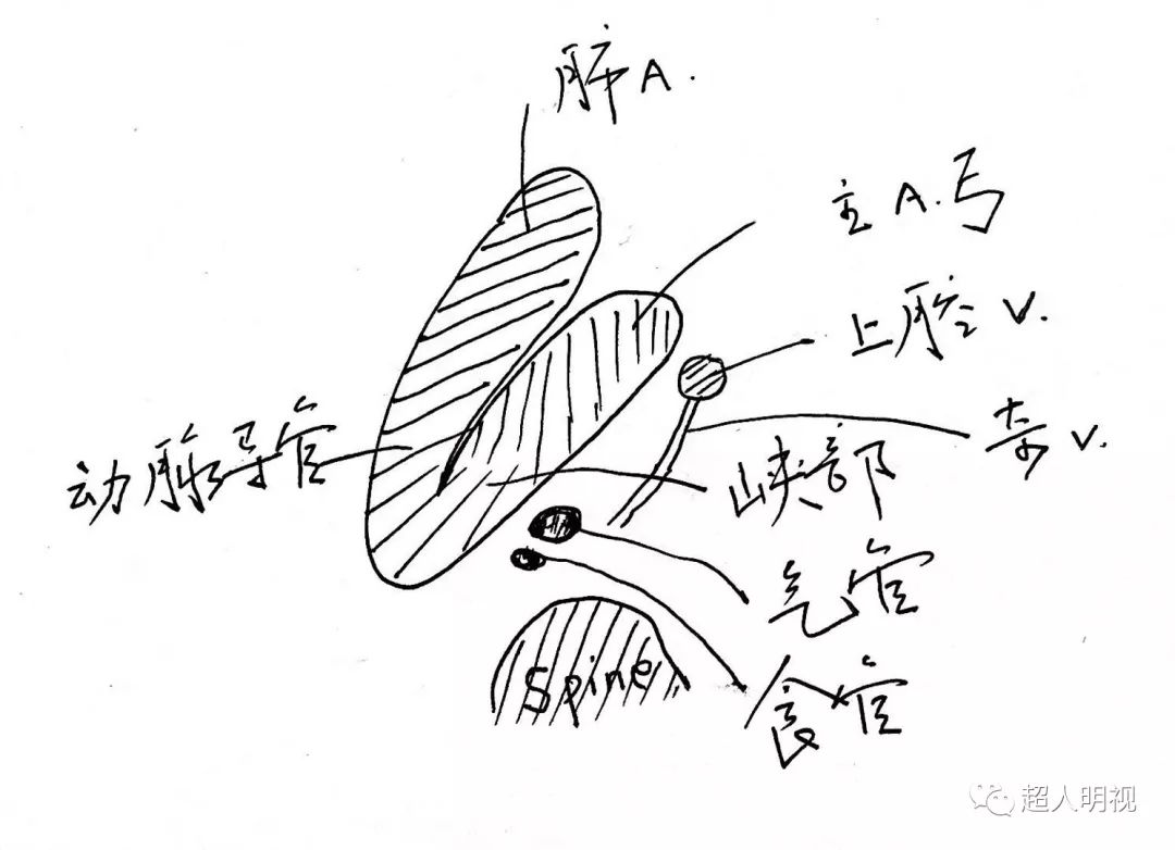 三血管切面示意图图片