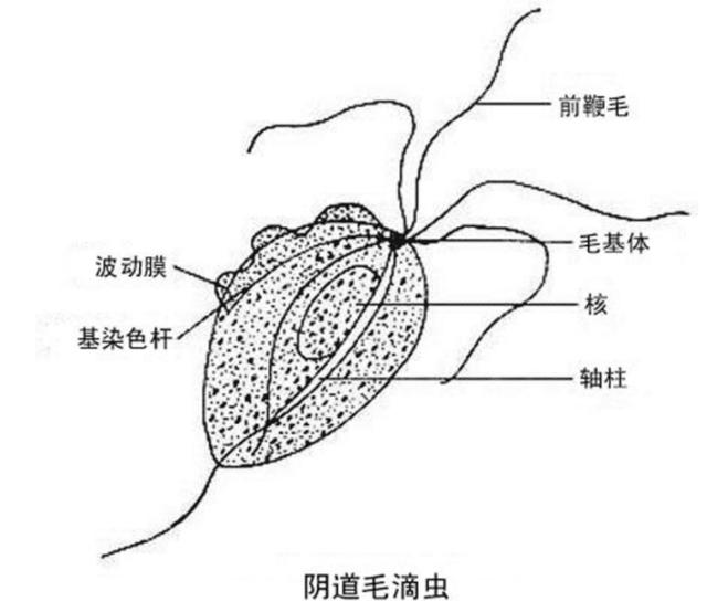 滴虫咬子宫图片图片