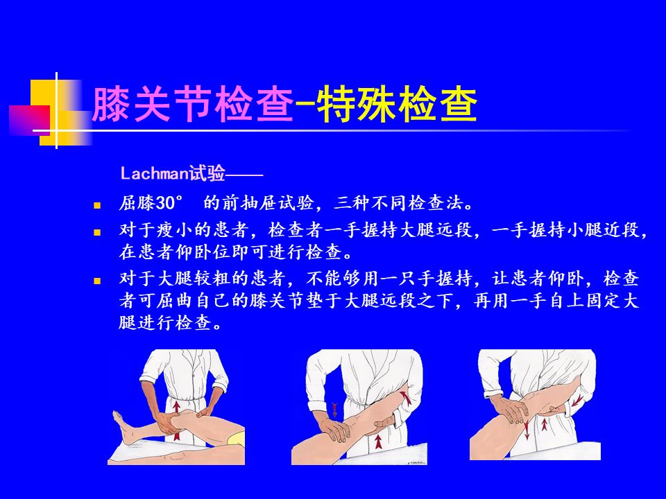 lachman试验图片