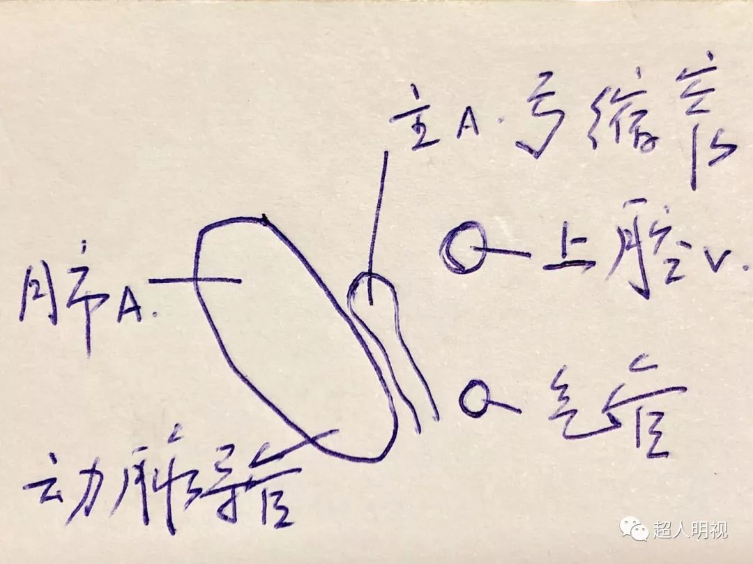 三血管气管切面异常图片