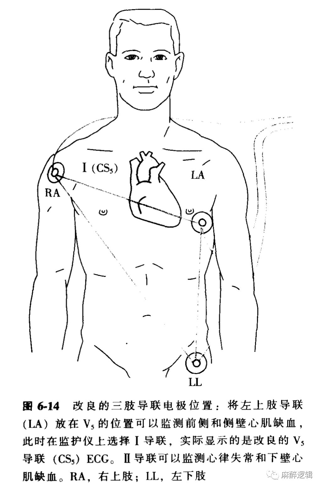 心脏定位标志及定位图片