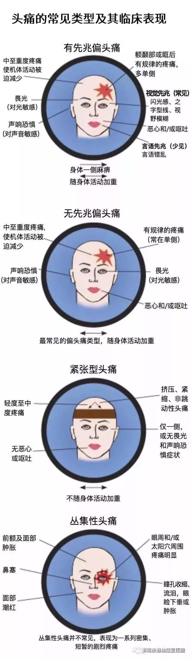 一图读懂常见的头痛类型
