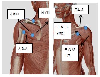 医案 肩部疼痛两年整,一次针灸见奇效