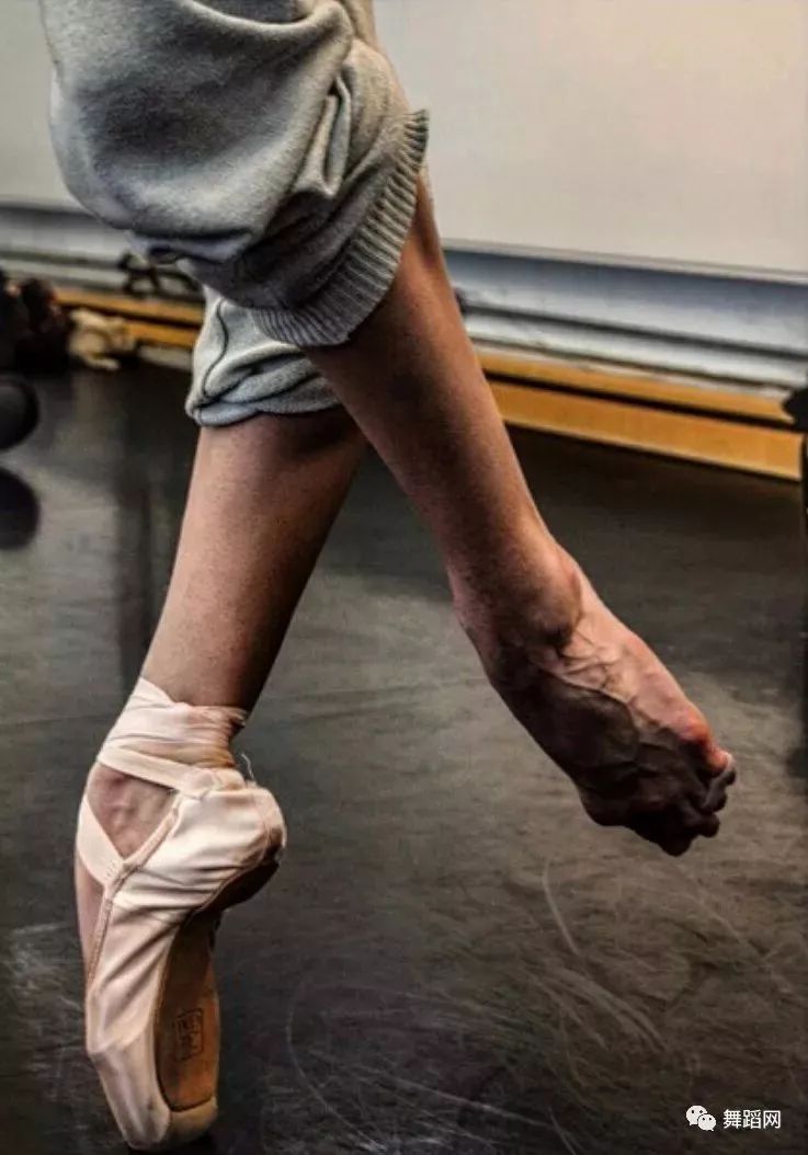 舞蹈生的腿痛苦图片