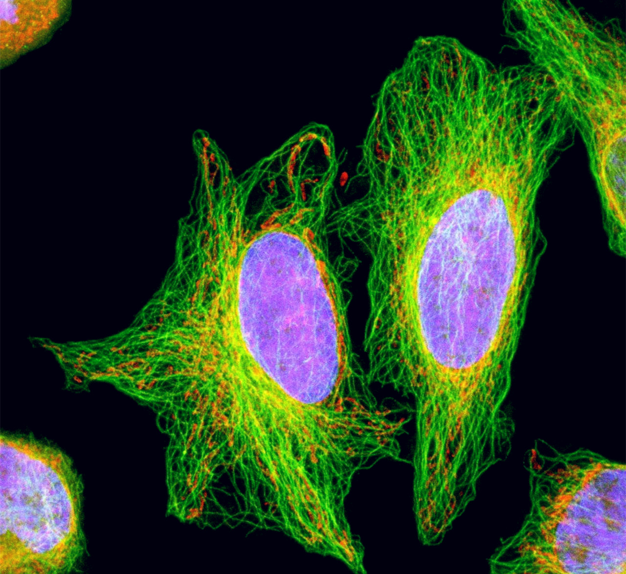 海拉细胞肉眼图片