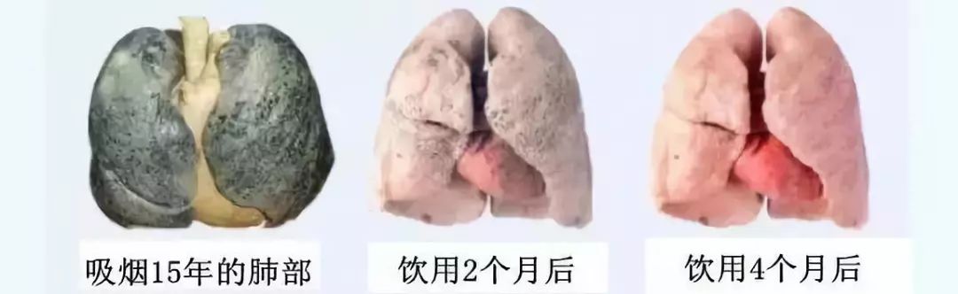 儿童吸二手烟的肺图片图片