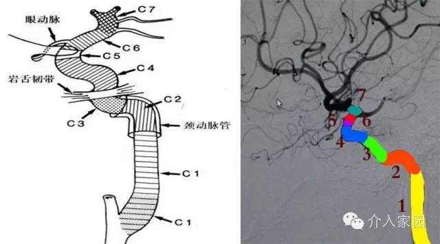 头颈部血管分段解剖图图片