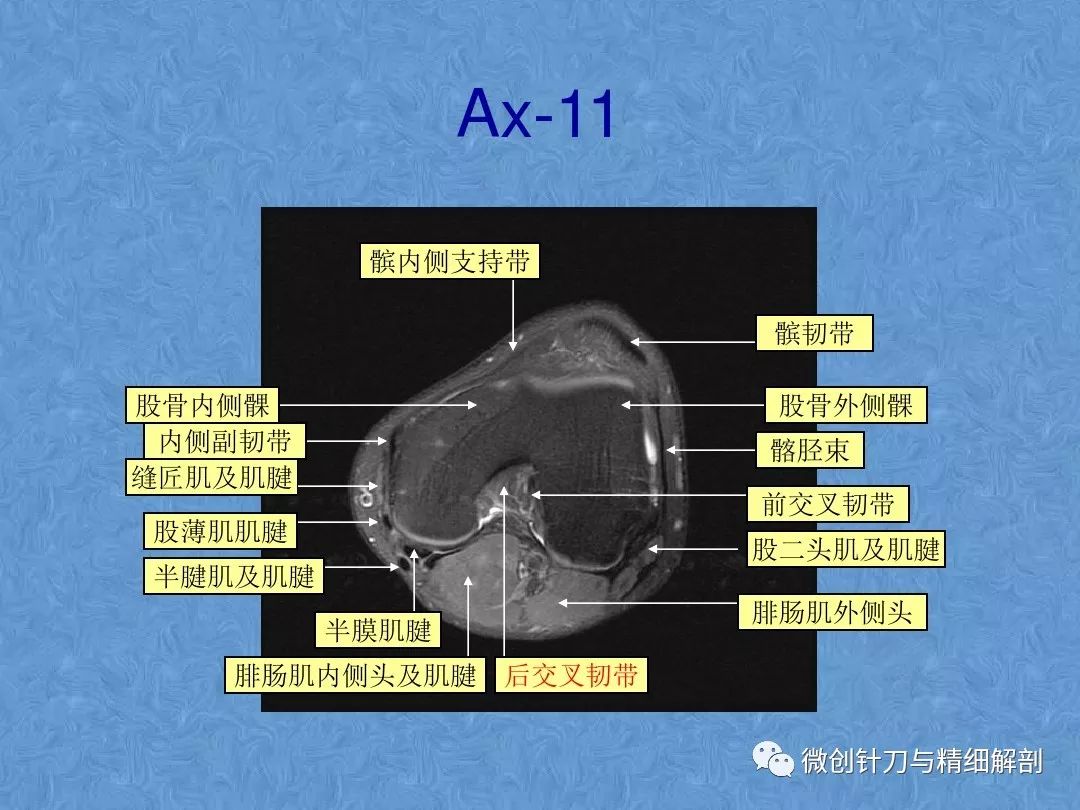 膝關節解剖影像