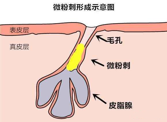 聽說你還在為長閉口而煩惱