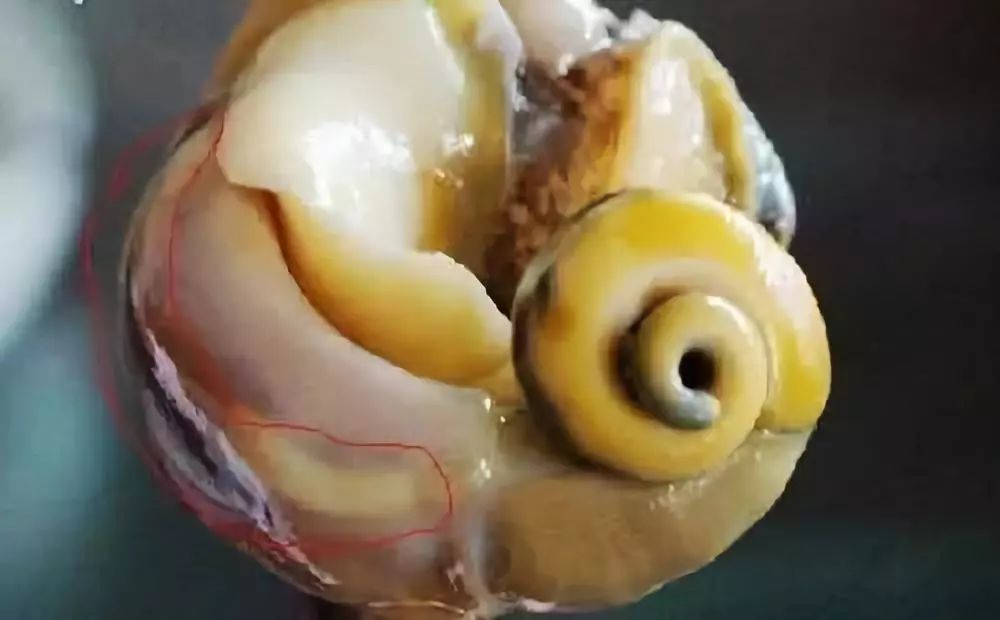海螺去除内脏图解图片
