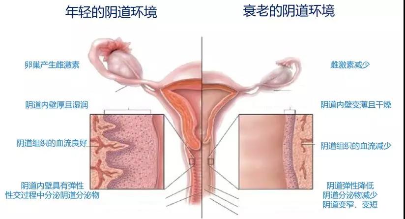 妇科结构 下面图片