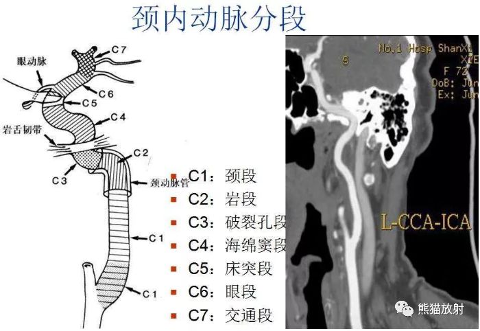 解剖丨頭頸部血管_動脈