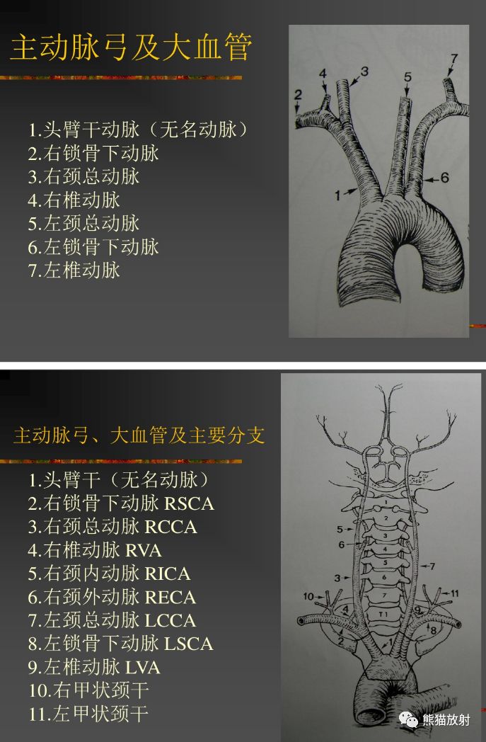 解剖丨頭頸部血管_動脈