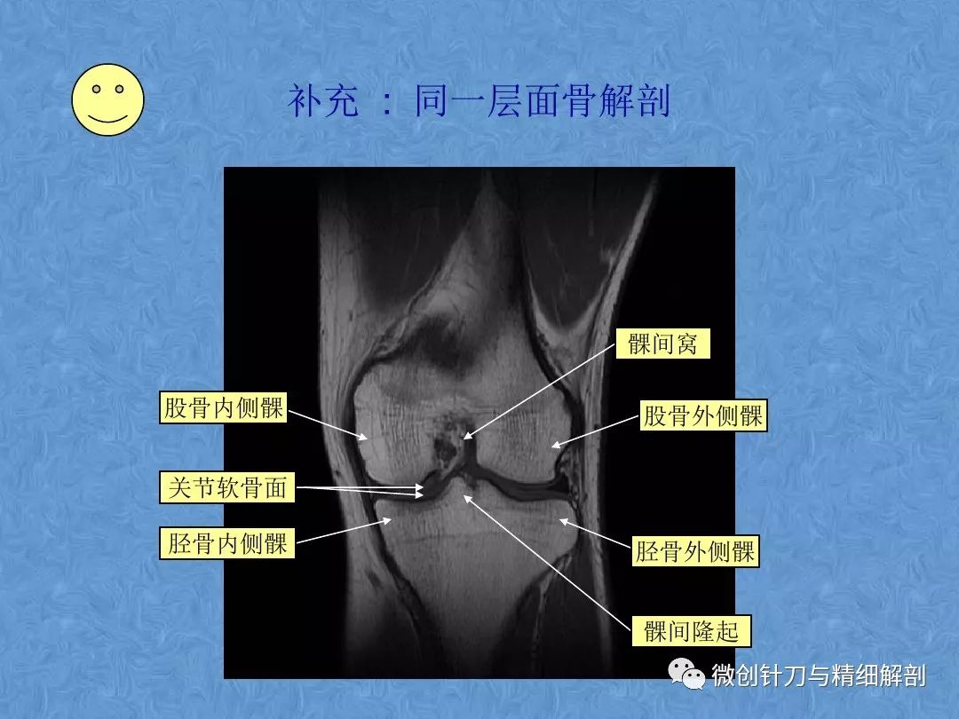 膝关节侧位解剖图片