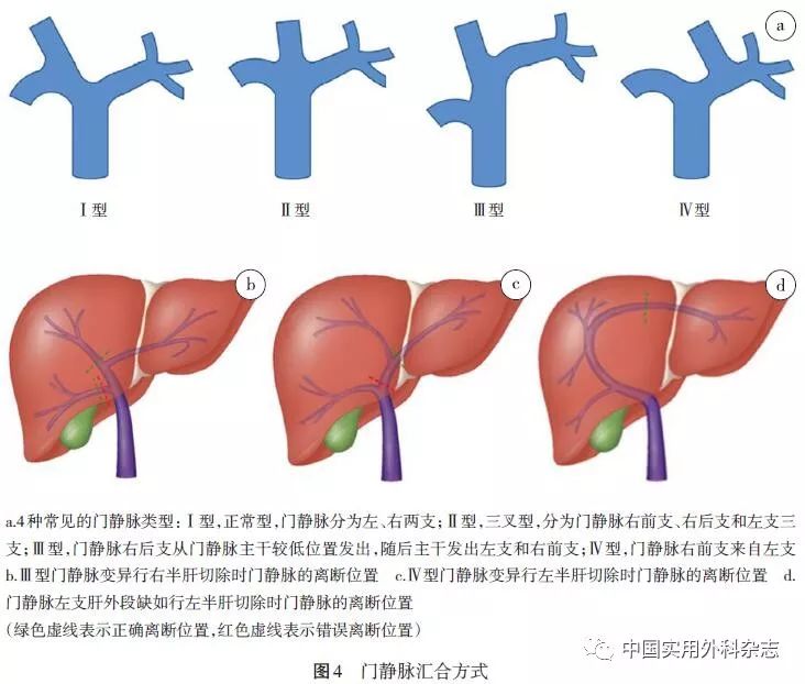 三个肝门的位置及组成图片