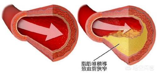 各營養物質,免疫活性物質,細胞代謝產物等將得到及時有效的運送,代謝