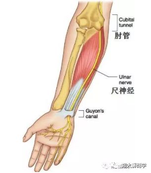 可以激惹尺神经:1 喙肱肌2 肱三头肌3 尺侧腕屈肌4 指深屈肌学习链接