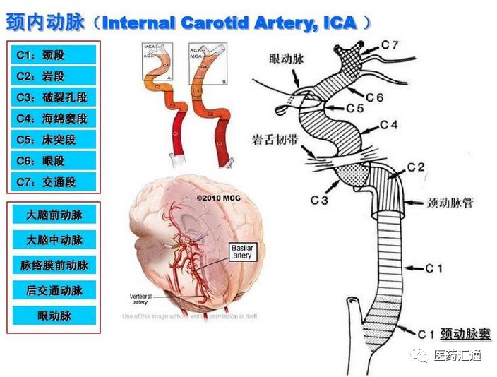颅内血管分段图片