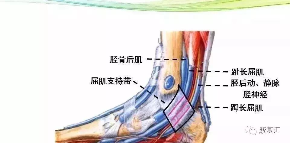 足底疼痛酸脹怎麼辦?超全踝管綜合徵治療方案_神經