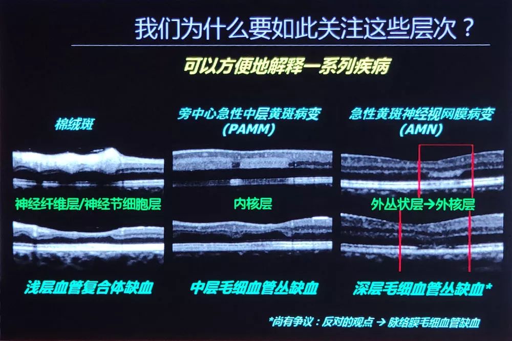 【retina china 2019】srini vas sadda教授:高分辨率oct-a揭秘視網膜