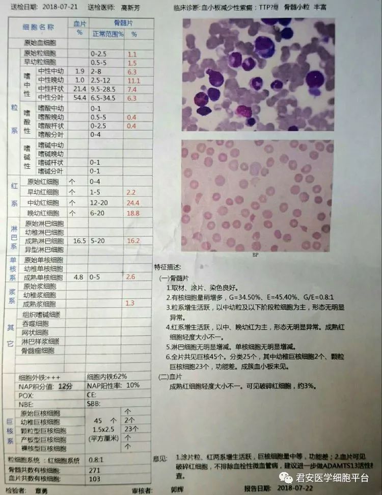 紫癜骨髓图片