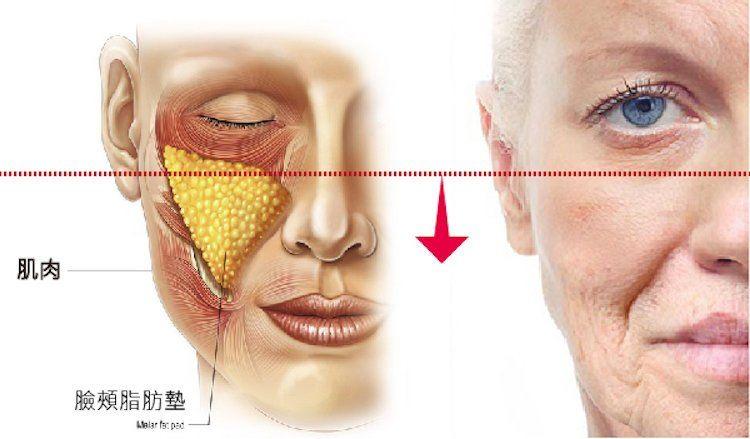 所以只關注祛皺,卻鮮少注意到皮膚底層的筋膜層也在一點點衰老