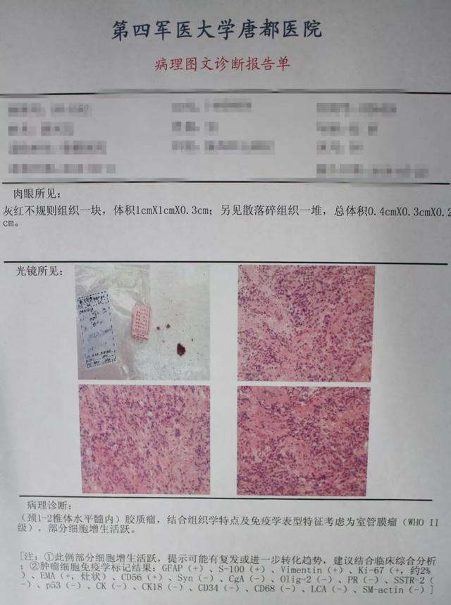 病例点评:颈1