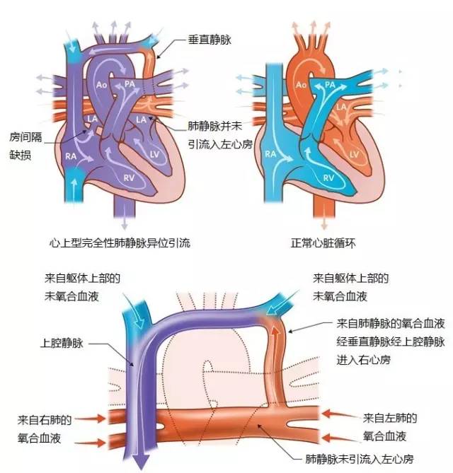 肺静脉分支图片