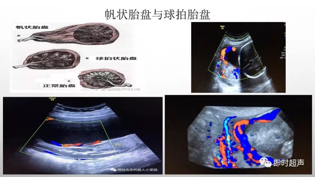 胎儿附属物示意图图片