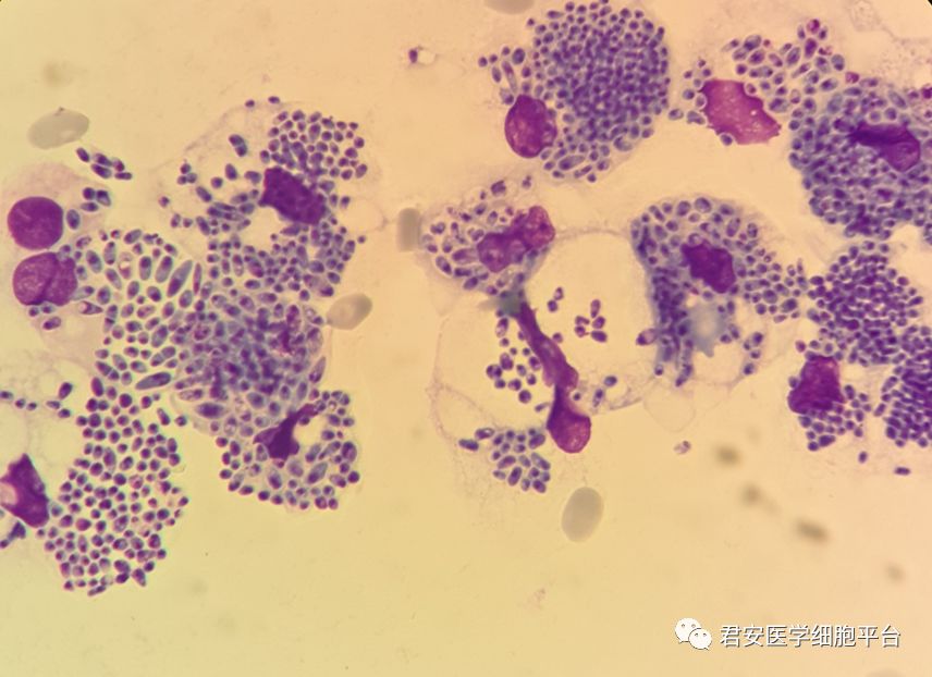 马尔尼菲蓝状菌图图片