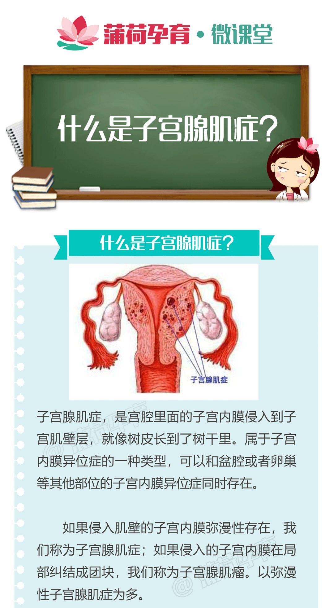 子宮腺肌症做了治療,還會復發嗎?