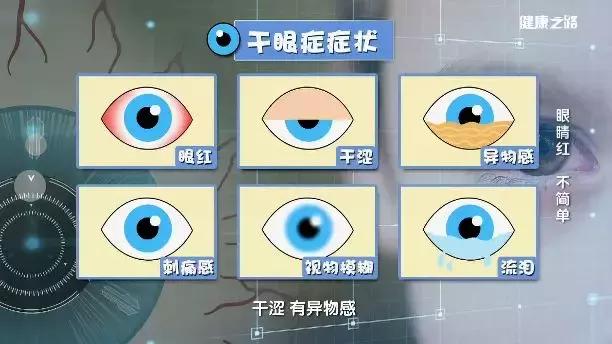 眼部疾病有哪些种类图片