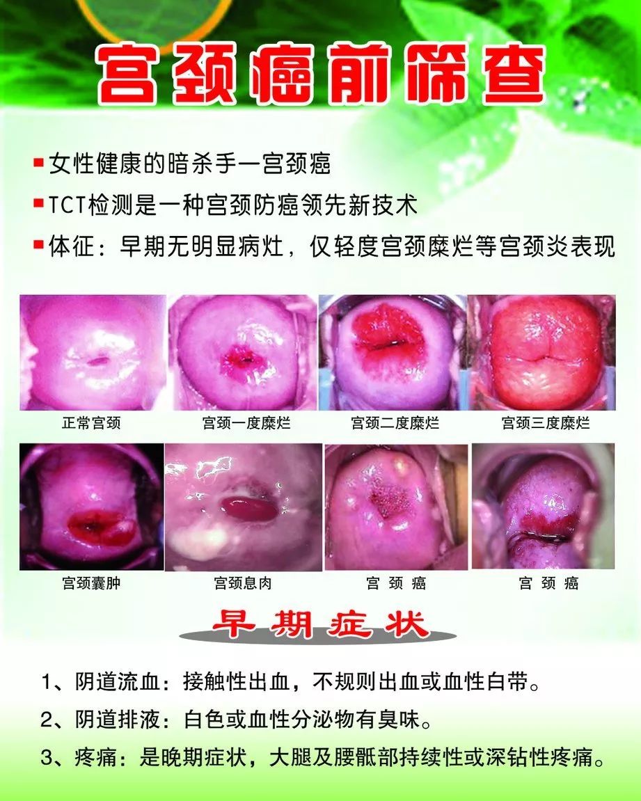 健康的宫颈图子宫口图片