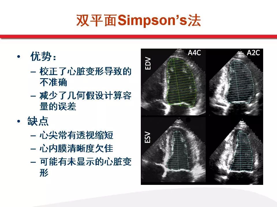 齐欣教授从 超声心动图在心衰患者诊治中的重要性, 超声心动图评价左