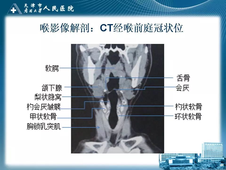 喉的應用解剖與影像解剖 | 影像天地