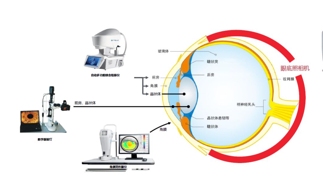 分鐘內篩查眼前節上千數據,形成關於雙眼度數,晝夜視差,視疲勞,白內障