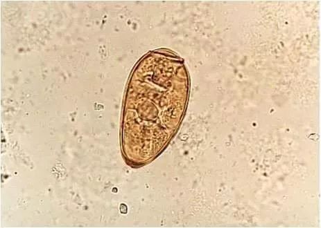 华支睾吸虫雷蚴图片