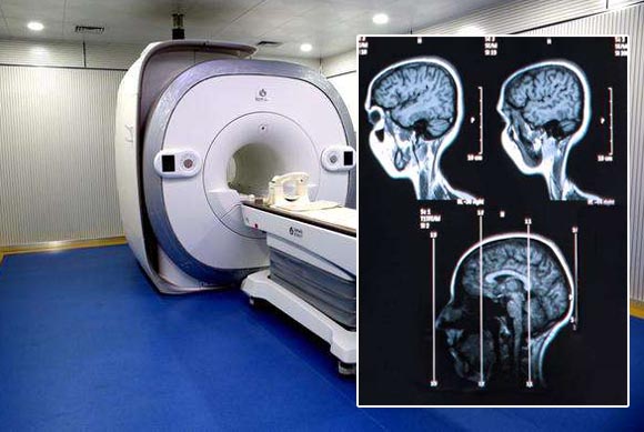 核磁共振成像技術在腦疾病檢查中的作用