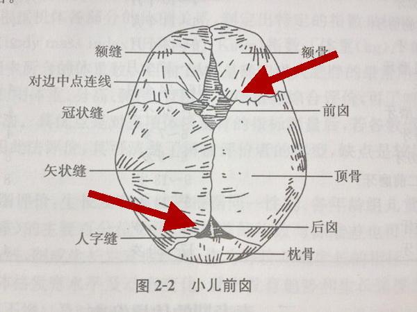 胎头的矢状缝解剖图图片