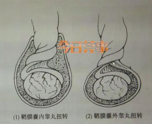 12岁小孩睾丸图片